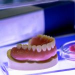 É Preciso Realizar Algum Tratamento Antes de Colocar os Implantes?